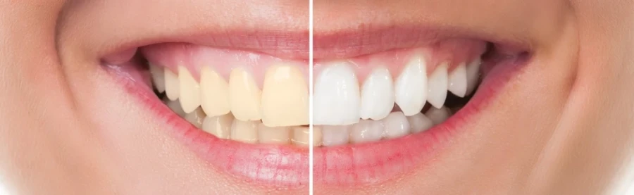 Відбілювання зубів Чернівці - знайдено 3 - Mobicard